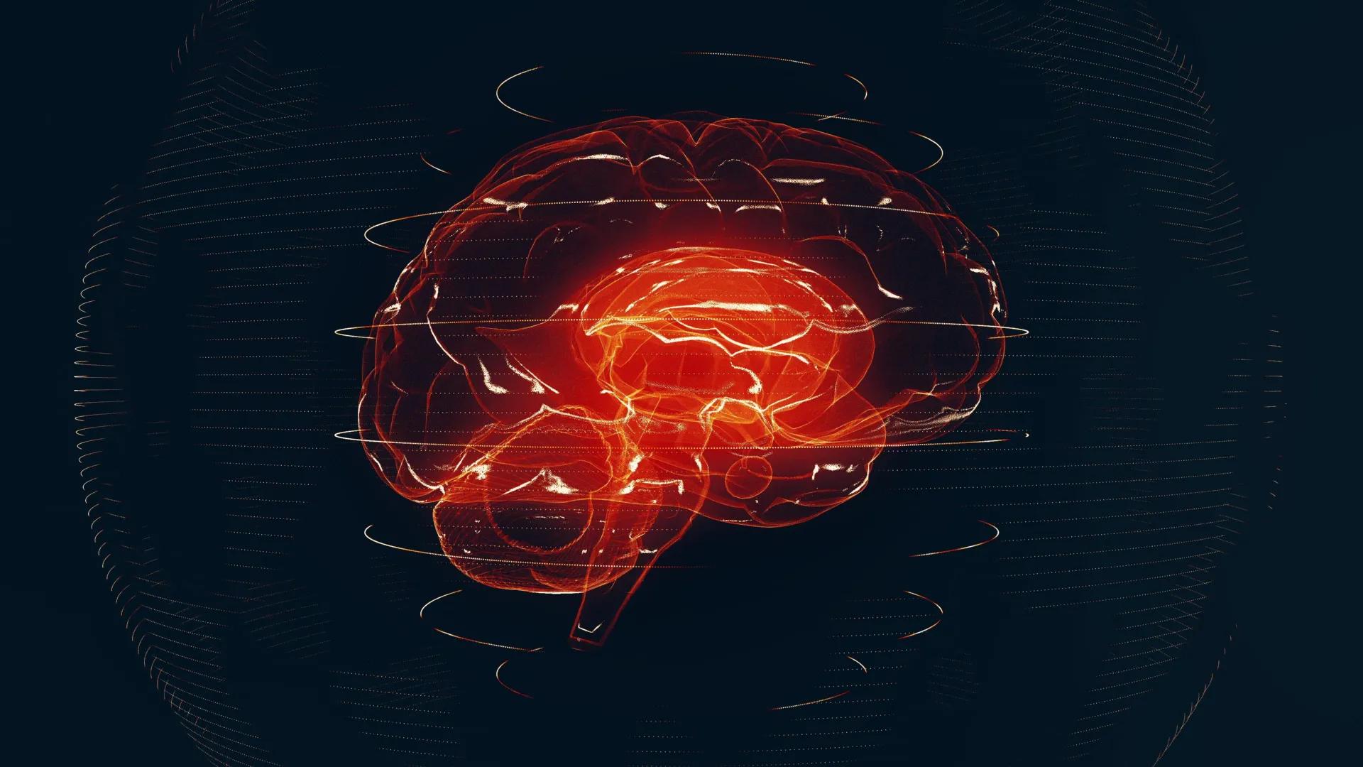 AI Reads Brain MRIs in Seconds, Flags Emergencies